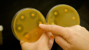 Vignette - [Avant-Scène Recherche] Nouvel épisode : Limiter l'antibiorésistance, un enjeu du 21e siècle